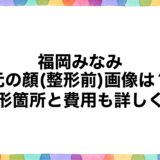 福岡みなみの元の顔(整形前)画像は？整形箇所と費用も詳しく！